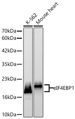4EBP1 Antibody in Western Blot (WB)