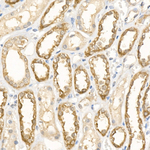 PRDX5 Recombinant Rabbit Monoclonal Antibody (2N7H10)