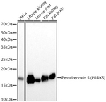 PRDX5 Antibody in Western Blot (WB)