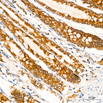 PPAP2B Antibody in Immunohistochemistry (Paraffin) (IHC (P))