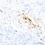 IL-8 Antibody in Immunohistochemistry (Paraffin) (IHC (P))