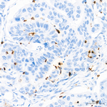 IL-8 Antibody in Immunohistochemistry (Paraffin) (IHC (P))