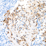 IL-8 Antibody in Immunohistochemistry (Paraffin) (IHC (P))