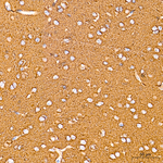 Acetyl-alpha Tubulin (Lys40) Antibody in Immunohistochemistry (Paraffin) (IHC (P))