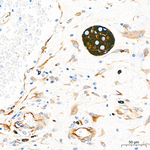 Acetyl-alpha Tubulin (Lys40) Antibody in Immunohistochemistry (Paraffin) (IHC (P))