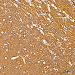 Acetyl-alpha Tubulin (Lys40) Antibody in Immunohistochemistry (Paraffin) (IHC (P))