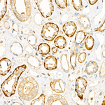 UBE2C Antibody in Immunohistochemistry (Paraffin) (IHC (P))