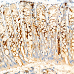 UBE2C Antibody in Immunohistochemistry (Paraffin) (IHC (P))