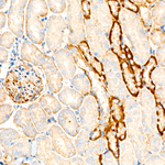 UBE2C Antibody in Immunohistochemistry (Paraffin) (IHC (P))