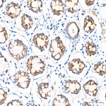 MTCO1 Antibody in Immunohistochemistry (Paraffin) (IHC (P))