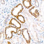 MTCO1 Antibody in Immunohistochemistry (Paraffin) (IHC (P))