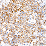 MTCO1 Antibody in Immunohistochemistry (Paraffin) (IHC (P))