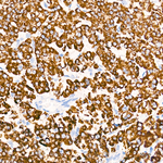 CPS1 Recombinant Rabbit Monoclonal Antibody (1V7X8)