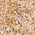 CPS1 Antibody in Immunohistochemistry (Paraffin) (IHC (P))