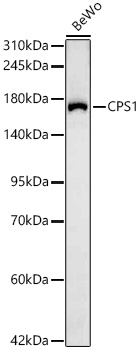 CPS1 Antibody in Western Blot (WB)