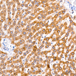 GLYAT Antibody in Immunohistochemistry (Paraffin) (IHC (P))