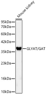 GLYAT Antibody in Western Blot (WB)