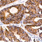 ACAT1 Antibody in Immunohistochemistry (Paraffin) (IHC (P))