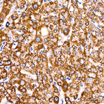 ACAT1 Antibody in Immunohistochemistry (Paraffin) (IHC (P))