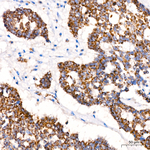 ACAT1 Antibody in Immunohistochemistry (Paraffin) (IHC (P))
