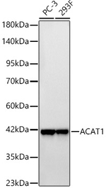 ACAT1 Antibody in Western Blot (WB)