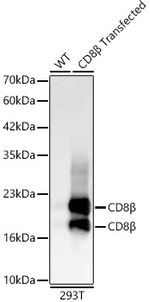 CD8b Recombinant Rabbit Monoclonal Antibody (1P5J10)