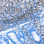 PU.1 Antibody in Immunohistochemistry (Paraffin) (IHC (P))