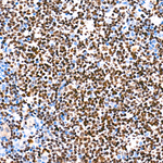PU.1 Antibody in Immunohistochemistry (Paraffin) (IHC (P))
