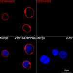 SERPINB3 Recombinant Rabbit Monoclonal Antibody (9R9K10)