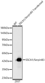 SERPINB3 Antibody in Western Blot (WB)