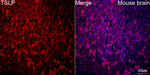 TSLP Antibody in Immunohistochemistry (Paraffin) (IHC (P))