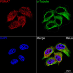 PSMA7 Recombinant Rabbit Monoclonal Antibody (1D2J3)