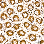 PSMA7 Antibody in Immunohistochemistry (Paraffin) (IHC (P))