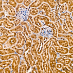 PSMA7 Antibody in Immunohistochemistry (Paraffin) (IHC (P))