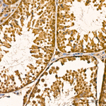 PSMA7 Antibody in Immunohistochemistry (Paraffin) (IHC (P))