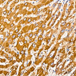 PCCB Antibody in Immunohistochemistry (Paraffin) (IHC (P))