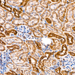 PCCB Antibody in Immunohistochemistry (Paraffin) (IHC (P))