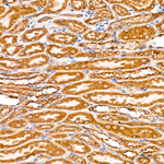 PCCB Antibody in Immunohistochemistry (Paraffin) (IHC (P))