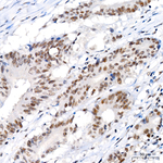 ZNF143 Antibody in Immunohistochemistry (Paraffin) (IHC (P))