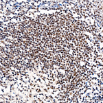 ZNF143 Antibody in Immunohistochemistry (Paraffin) (IHC (P))