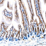 ZNF143 Antibody in Immunohistochemistry (Paraffin) (IHC (P))