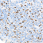 RACGAP1 Antibody in Immunohistochemistry (Paraffin) (IHC (P))