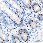 RACGAP1 Antibody in Immunohistochemistry (Paraffin) (IHC (P))