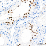 RACGAP1 Antibody in Immunohistochemistry (Paraffin) (IHC (P))