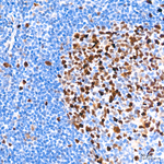 RACGAP1 Antibody in Immunohistochemistry (Paraffin) (IHC (P))