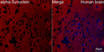 alpha Synuclein Antibody in Immunohistochemistry (Paraffin) (IHC (P))