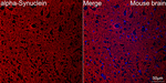alpha Synuclein Antibody in Immunohistochemistry (Paraffin) (IHC (P))