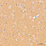 alpha Synuclein Antibody in Immunohistochemistry (Paraffin) (IHC (P))