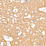 alpha Synuclein Antibody in Immunohistochemistry (Paraffin) (IHC (P))