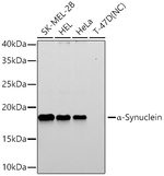 alpha Synuclein Antibody in Western Blot (WB)